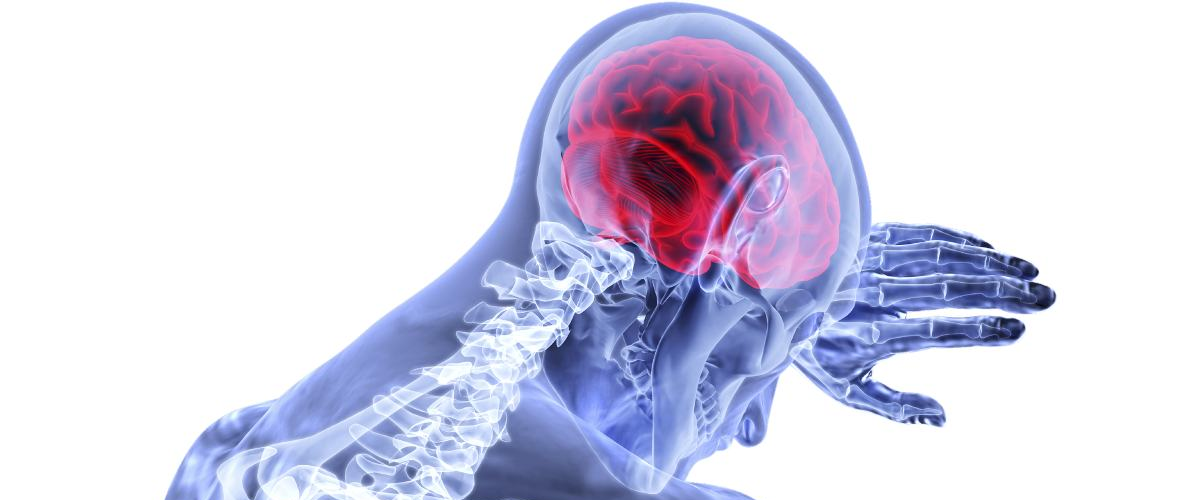 Hipoxia cerebral causas, síntomas y factores de riesgo