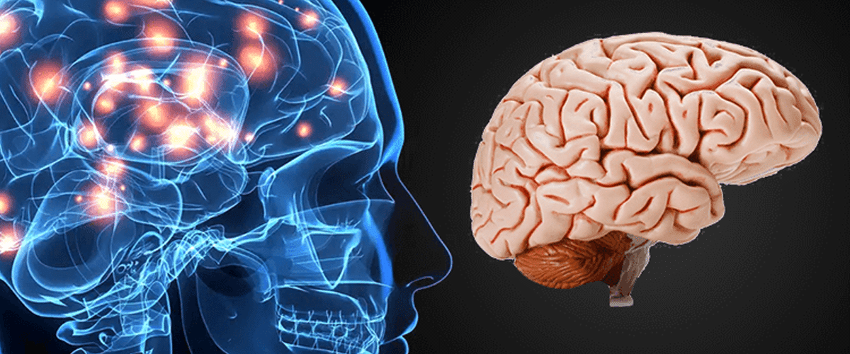 Brain and some. Мозг картина. SNR Yigma cerebral Cortex. Cerebral Engorgement - Gastrointestinal Bleeding (2013).