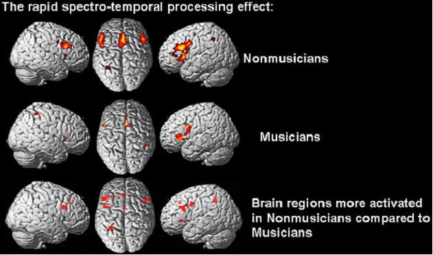 Diagrama del Cerebro Humano