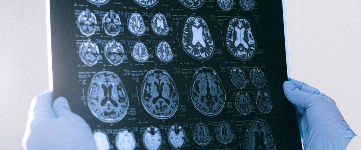 Entendiendo el cerebro cómo se mide la actividad cerebral