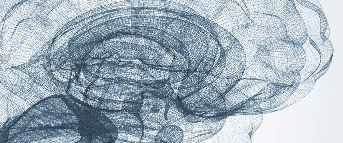 oligodendroglioma